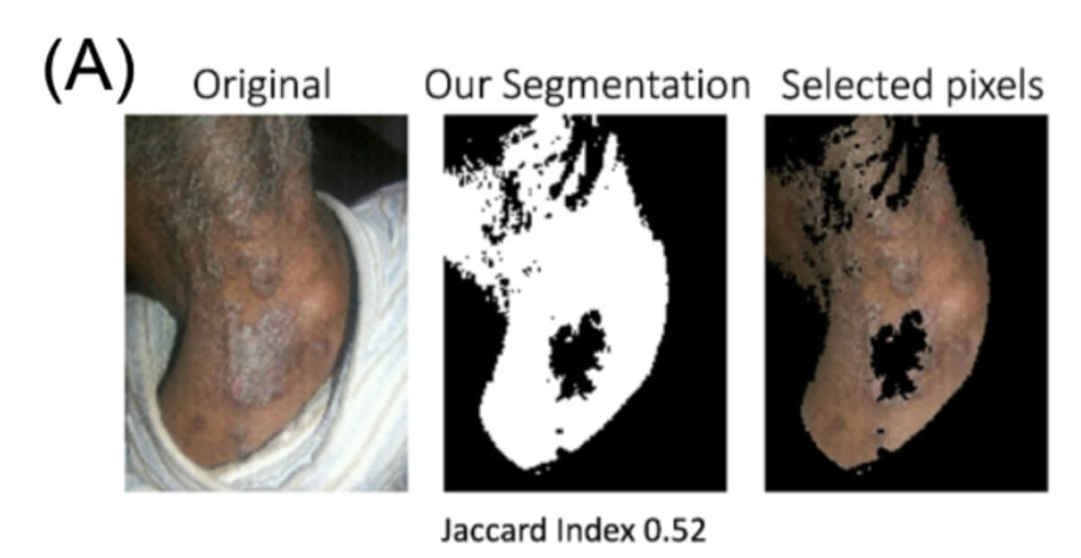Darker Skin Segmentation