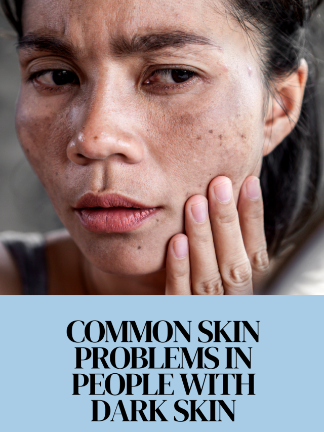 Common Skin Problem in People of Color Laser and other Treatments for